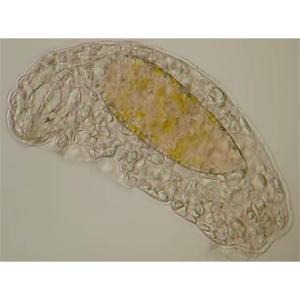 What are Water Bears?